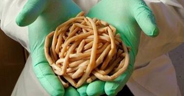 Parasites removed from the human body