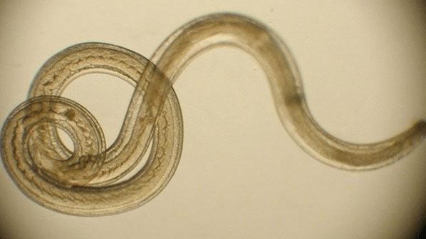 worm parasite from the human body