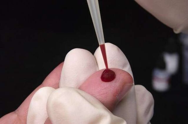 take blood for analysis for parasites