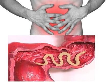 Symptoms of chronic helminthiasis are dyspeptic intestinal disorders
