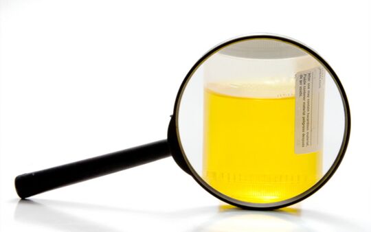 Urine examination for the diagnosis of schistosomiasis
