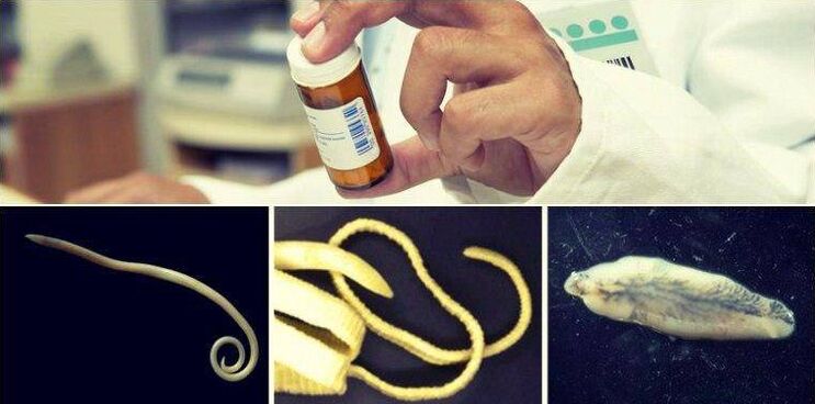 Types of worms and the medicinal method of getting rid of them